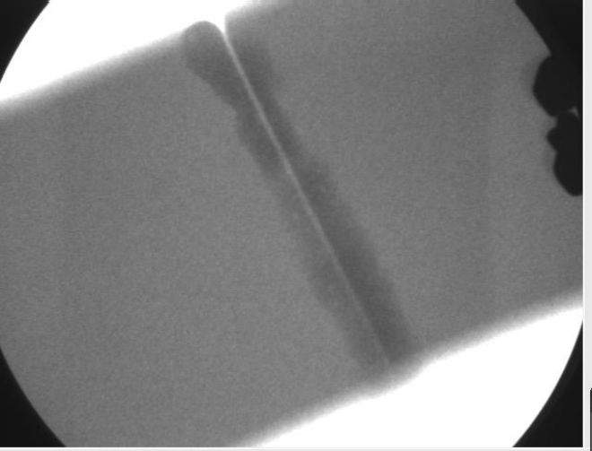 X-ray Inverse of a weld on an aluminum plate
